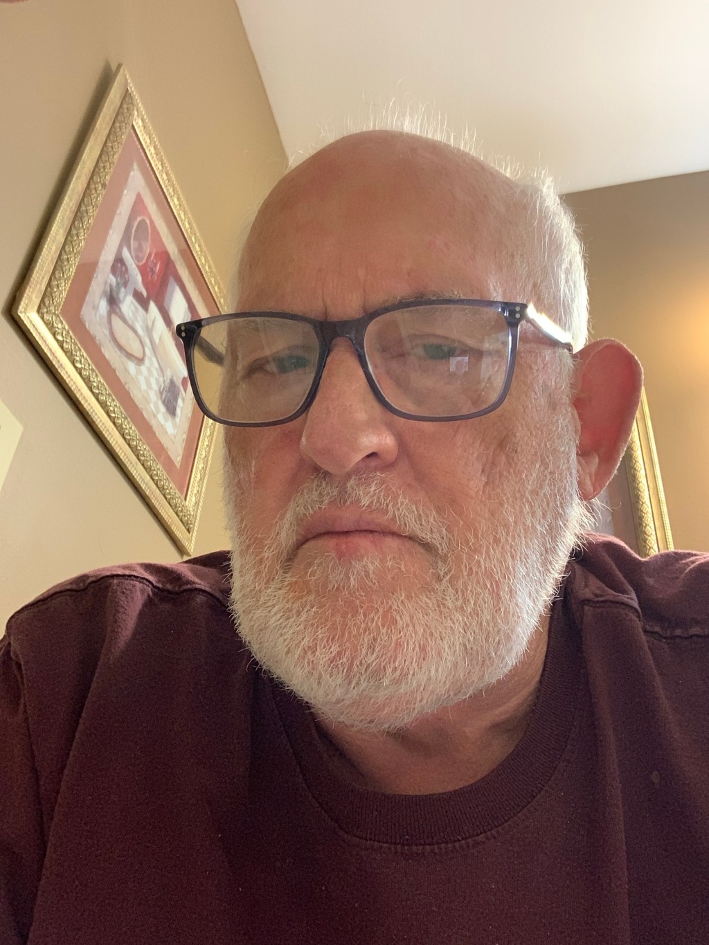 The Pain of Ignoring&nbsp;Variation